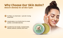 Pine Skin Balm – Natural Moisturizing Pine Balm (2 oz)