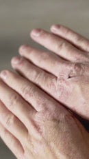 Pine Skin Balm – Natural Moisturizing Pine Balm (2 oz)