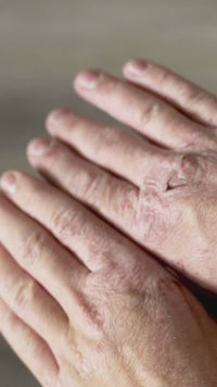 Pine Skin Balm – Natural Moisturizing Pine Balm (2 oz)